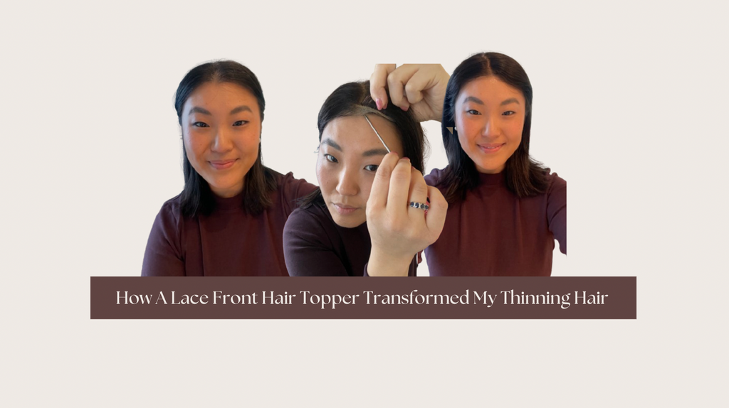 How A Lace Front Hair Topper Transformed My Thinning Hair